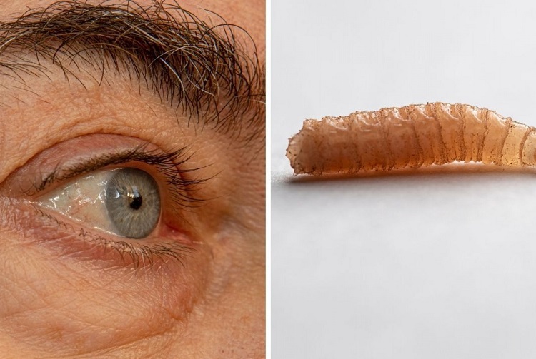 Dreams of larvae in the eyes